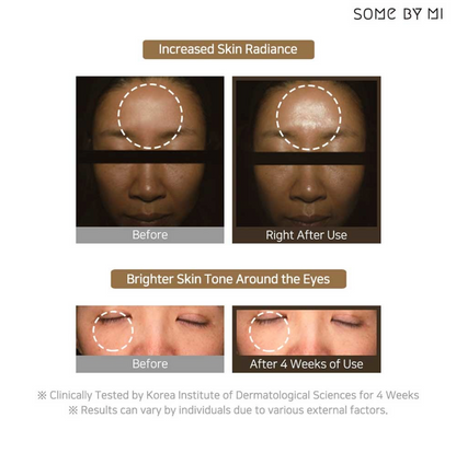 Some By Mi Galactomyces Pure Vitamin C Glow Serum bevat 75% van Galactomyces en 30.000ppm Pure Vitamin C voor een intensieve verhelderende verzorging